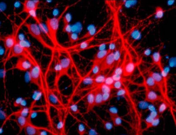 Anti-MAP2 Antibody, clone AP20 | MAB3418